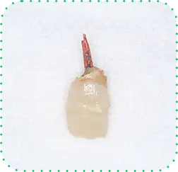 症例写真
