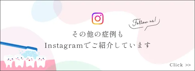 その他の症例もInstagramでご紹介しています